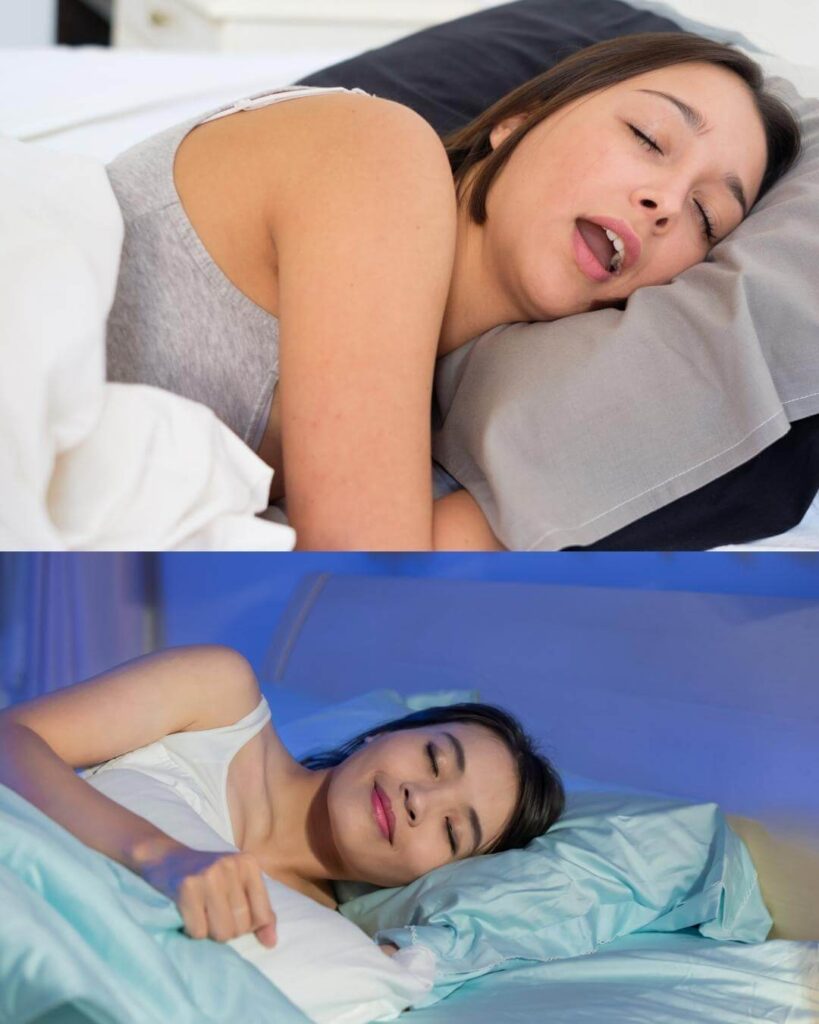 Uso de la mentonera en la apnea del sueño