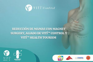 Lee más sobre el artículo Reducción de Mamas con Magnet Surgery, aliado de VITÍ™ CONTROL y VITÍ™ HEALTH TOURISM 